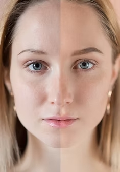 Armonización Facial