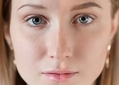 ¡Armonización Facial en Anzures, muy cerca de ti!